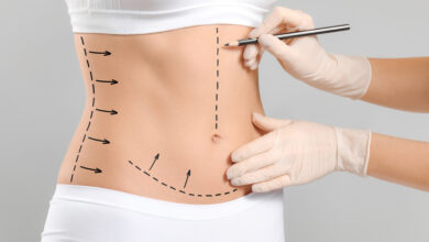 Is a Tummy Tuck Right for You?