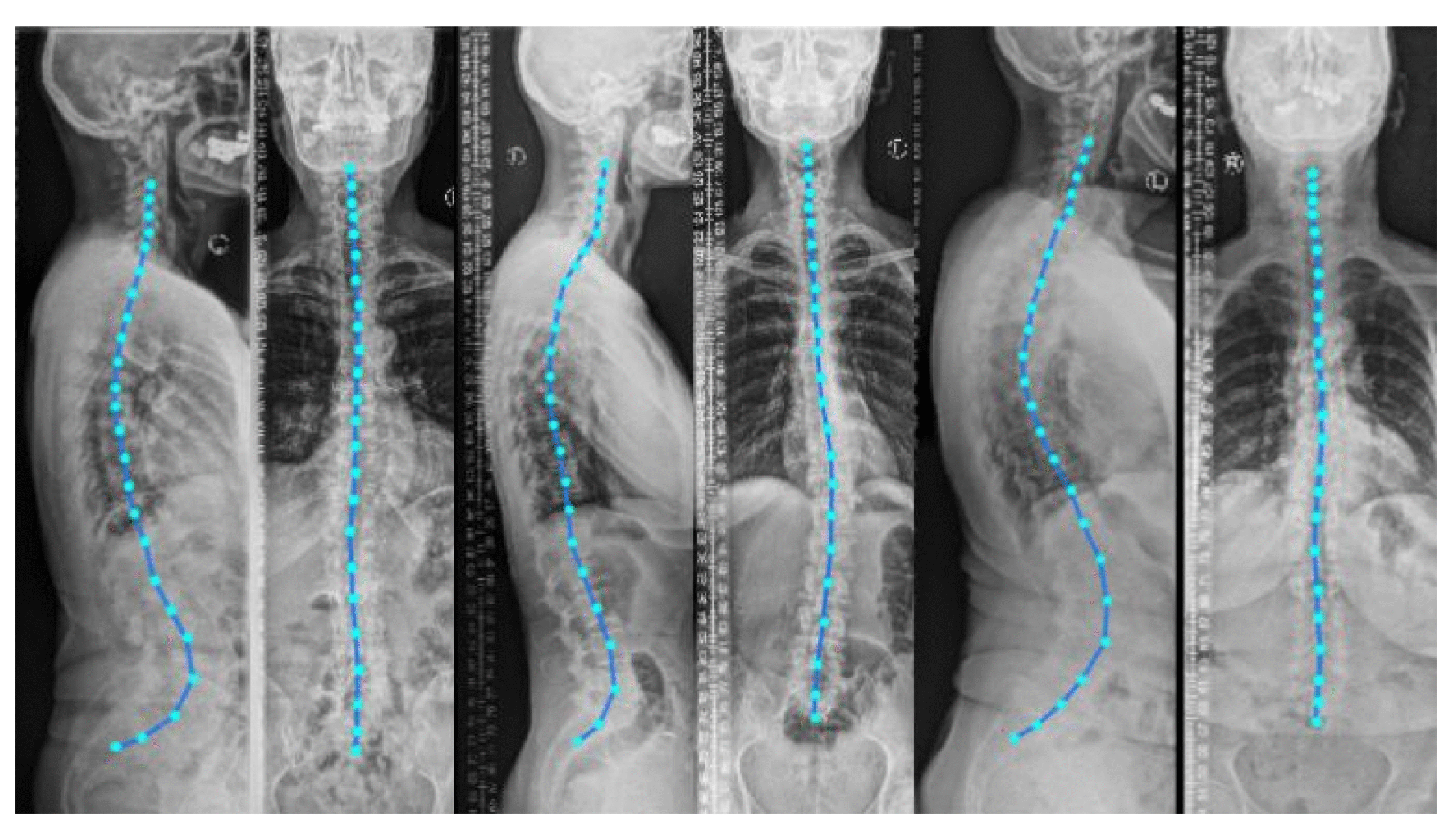 From Design to Function: The Journey of Creating the AnatomiQ Curved Board