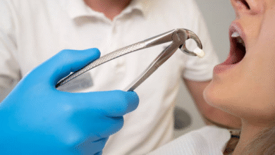 HOW ORAL SURGEONS HANDLE IMPACTED TEETH